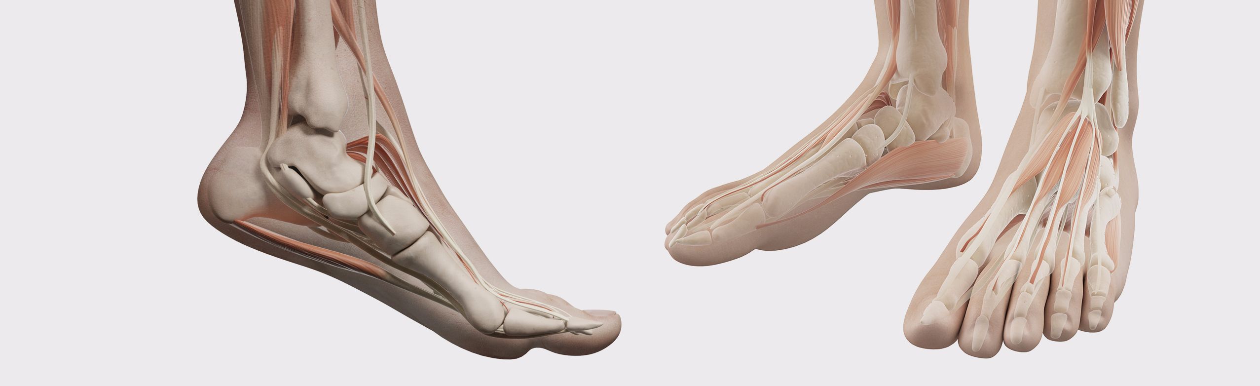 Alluce_Valgo_piedi